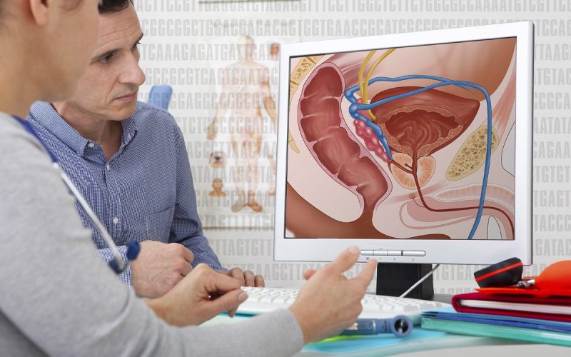 Early Prostate Cancer Diagnosis Rates Rise as New Screening Guidelines Take Effect 1 Prostate Cancer